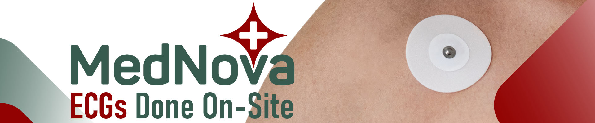 ECG pad on person's shoulder