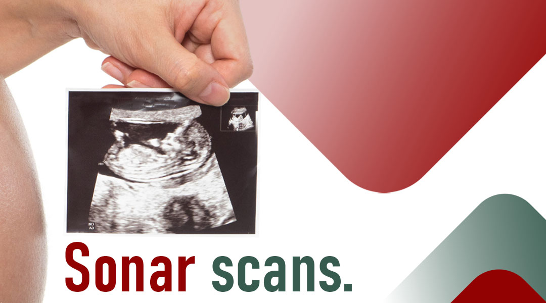 Person's hand holding up sonar scan